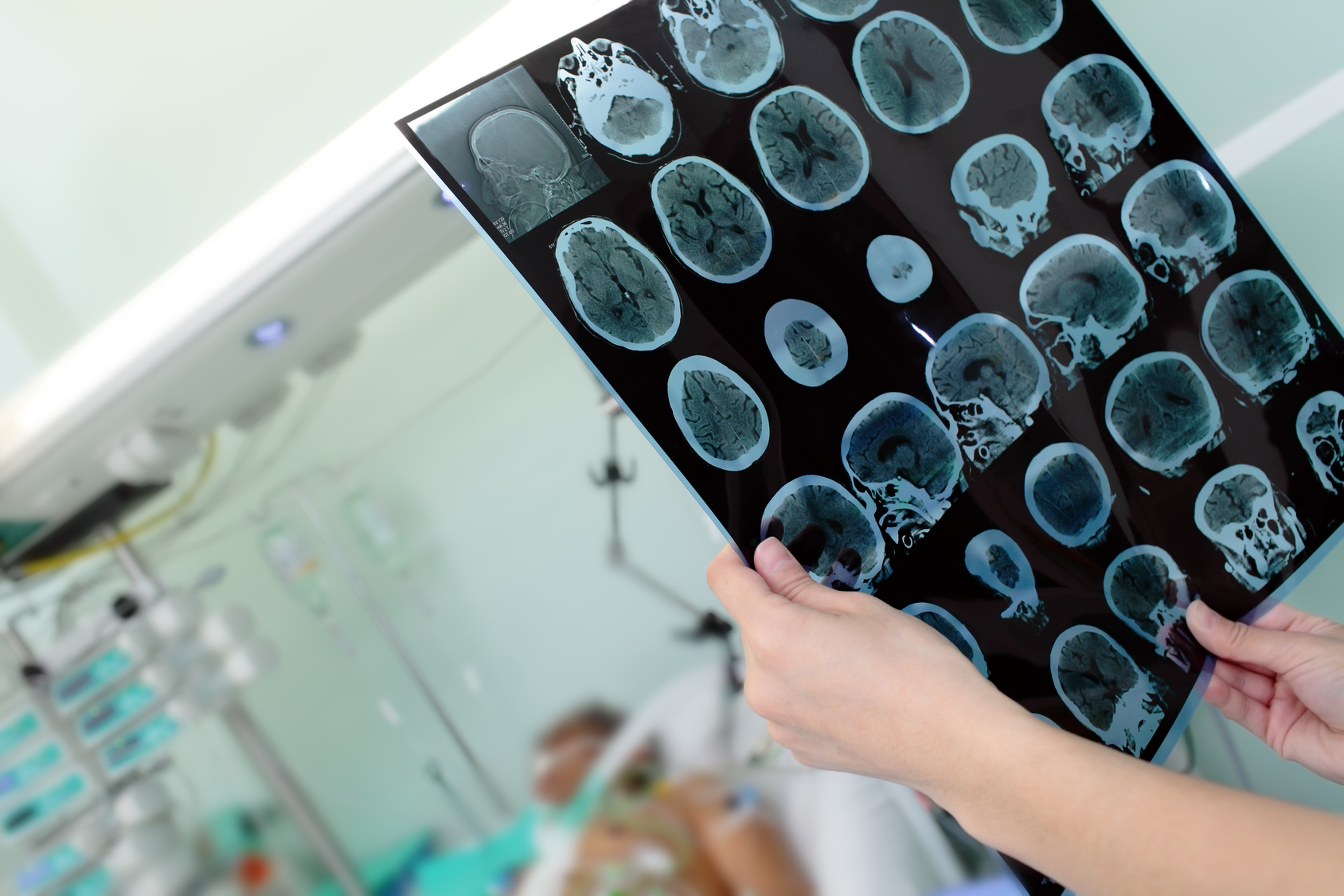 Wymiana sprzętu radiologicznego