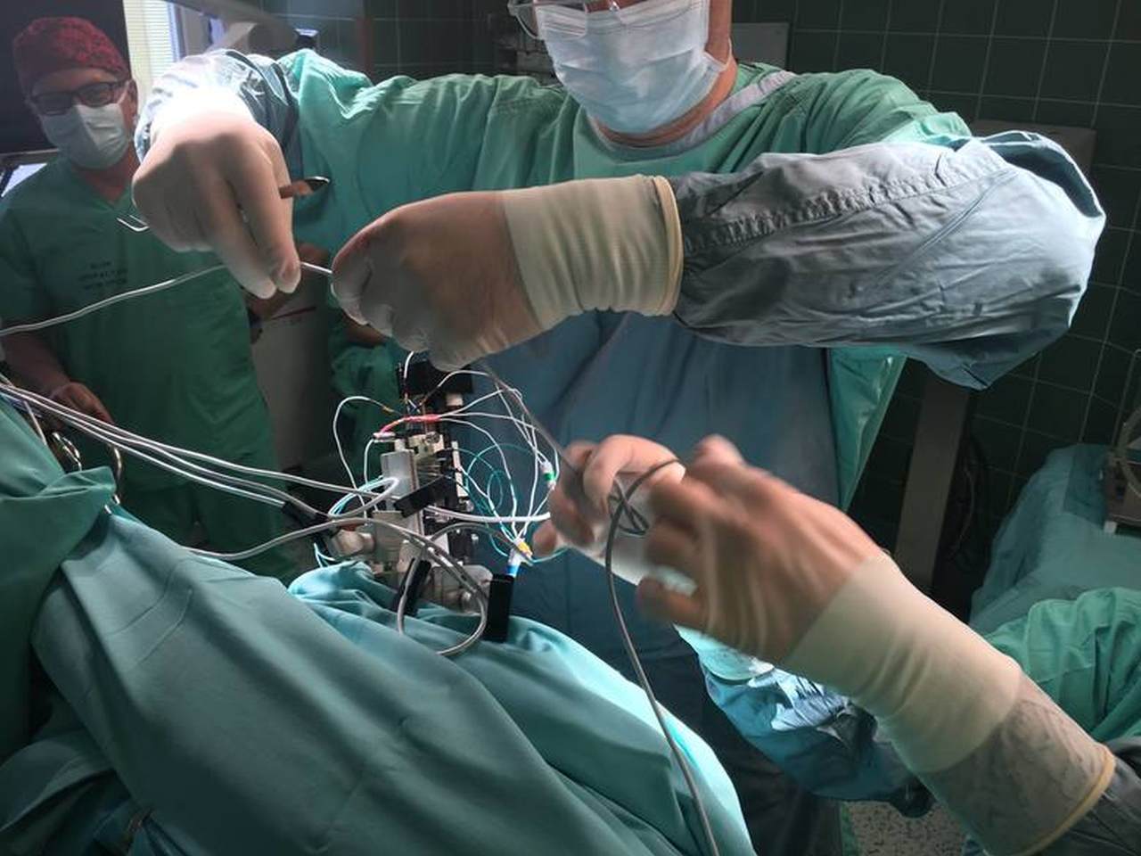 Udana operacja DBS w Opolu