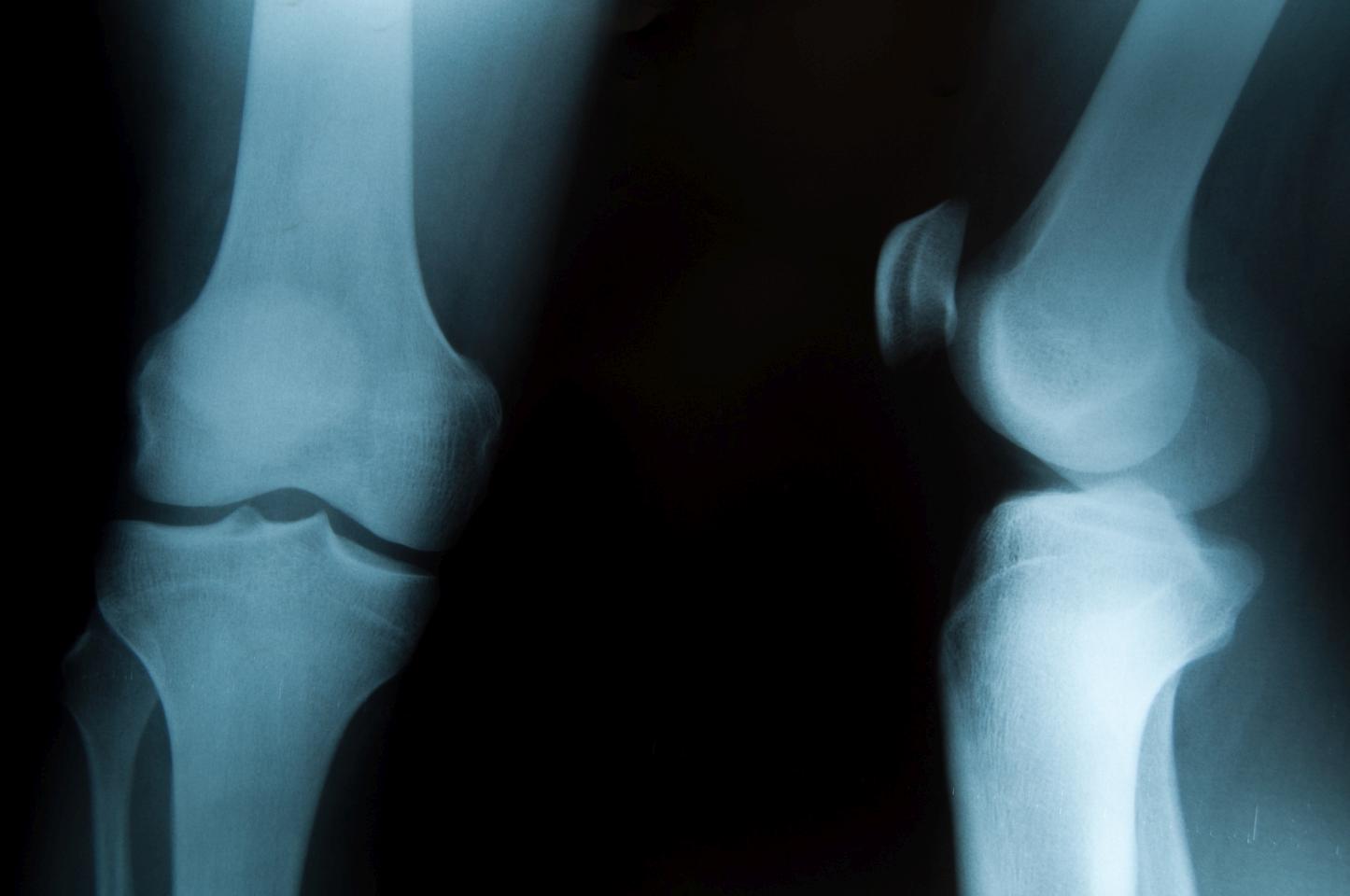 Modernizacja szpitala w Zielonej Górze