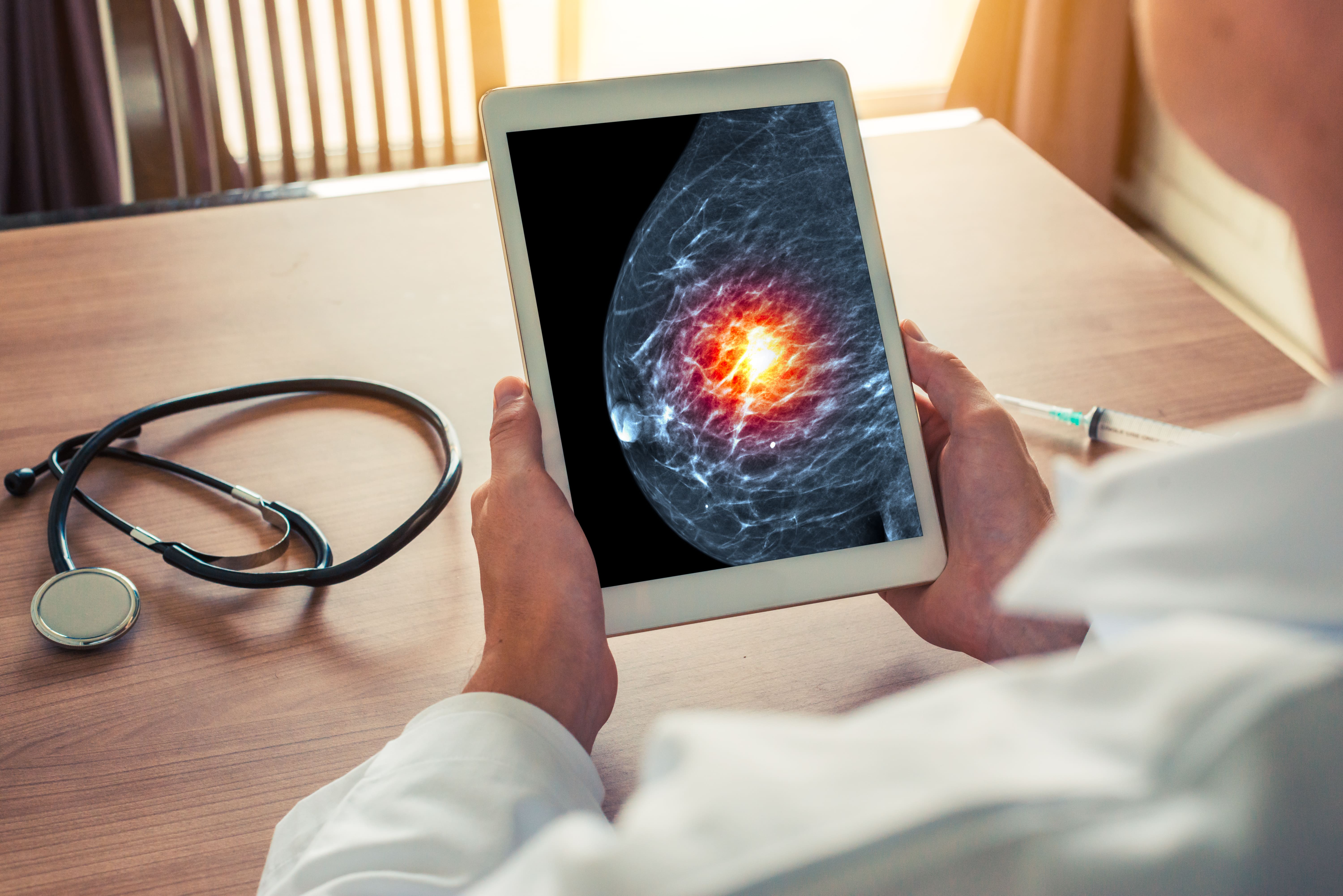 Breast Cancer Unit - nowy projekt Ministerstwa Zdrowia