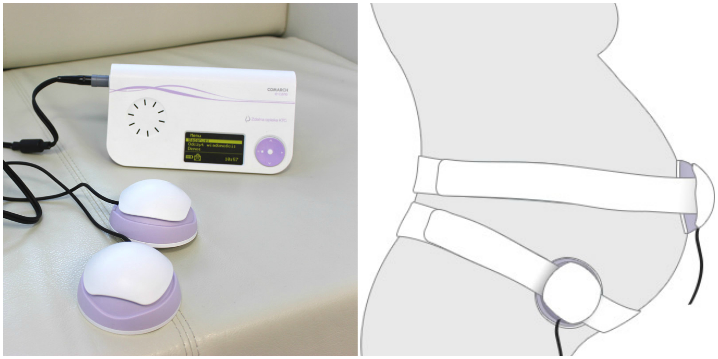 Skierniewice pozytywnie nastawione do telemedycyny