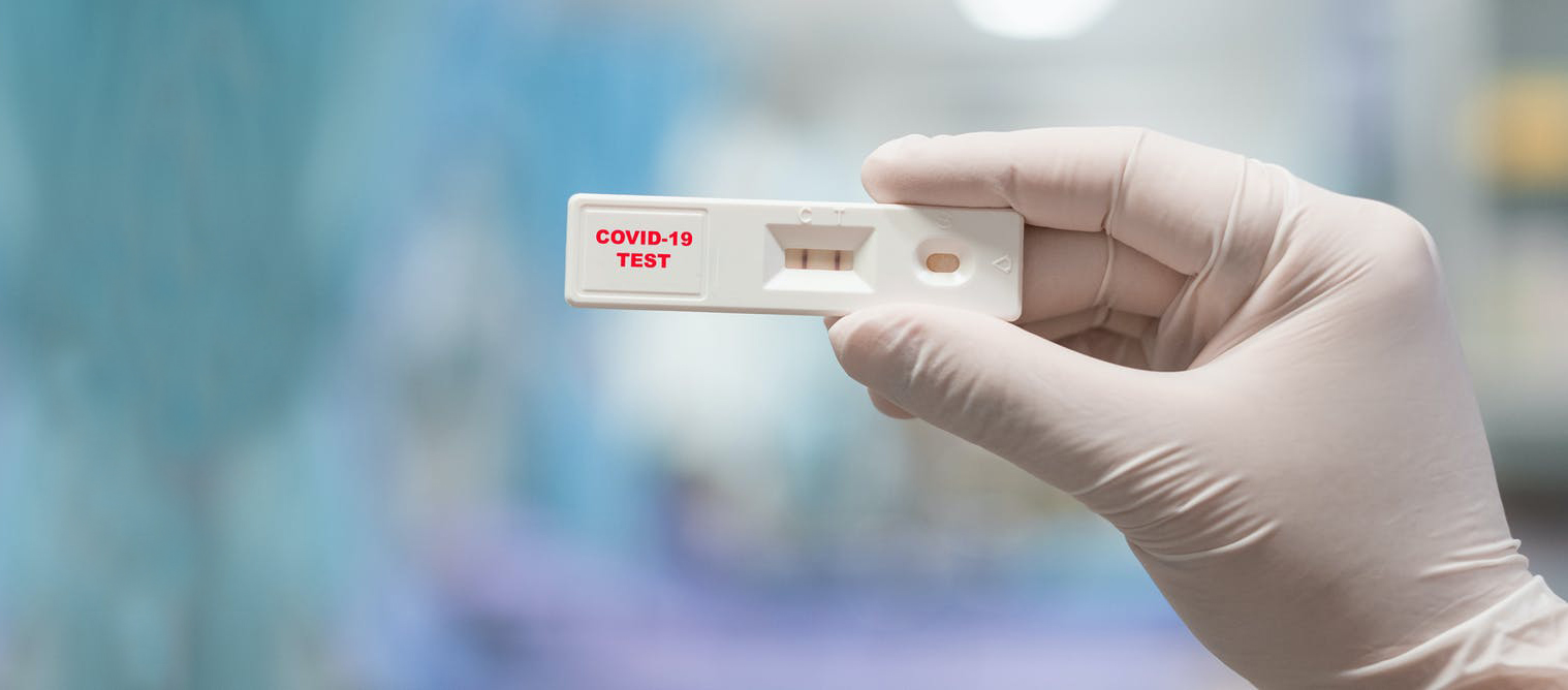 Kto przechorował COVID-19? Rusza ogólnopolskie badanie